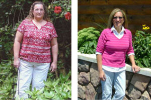 Cindy_weight_loss_sugery_before_after Before and after weight loss surgery